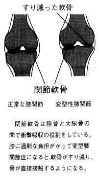 ひざのしくみ２