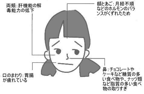 にきぴの位置と原因