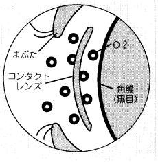 角膜が酸素不足