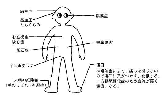 糖尿病により全身に現れる障害図